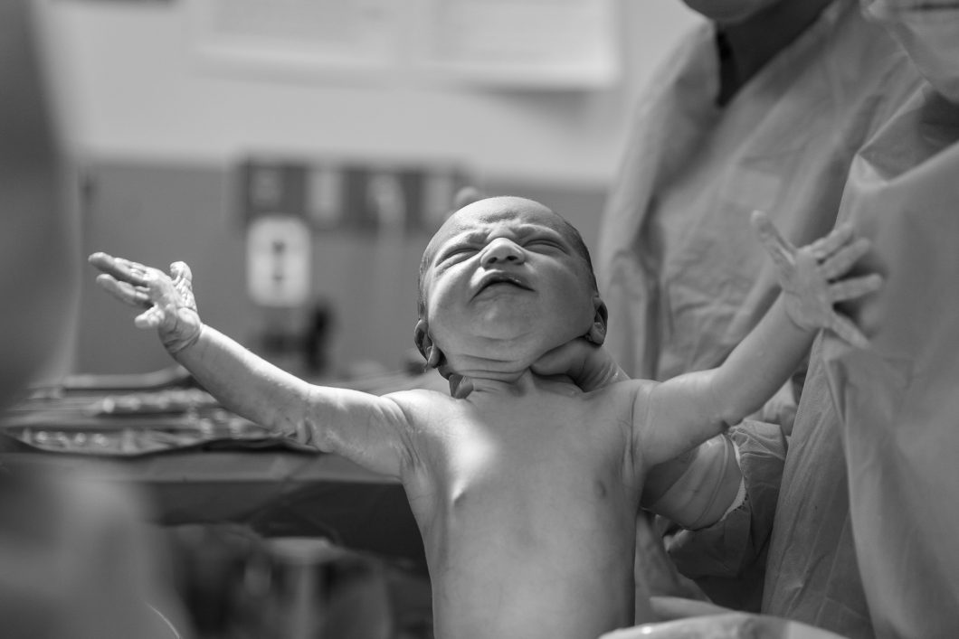 Ein Schwarz-weiß-Bild von einem Neugeborenen direkt nach der Geburt